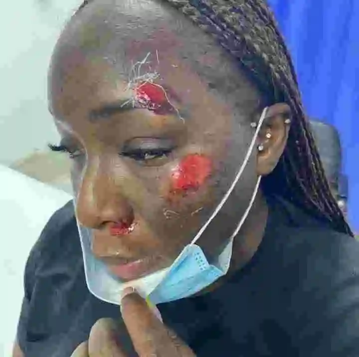 Oh No! See What Happened to Woman While Jogging On The Lekki-Ikoyi Link Bridge (Graphic Photos)