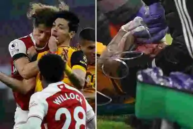 Wolves striker, Raul Jimenez suffers fractured skull after head clash with David Luis in Arsenal game; undergoes surgery